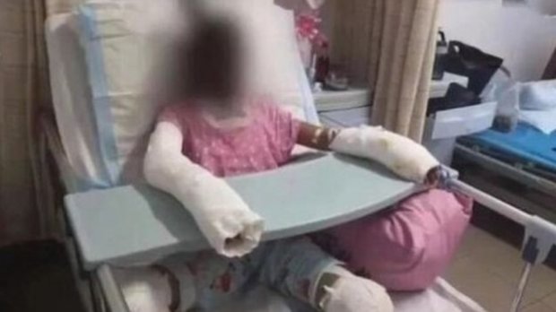Дівчинка померла, намагаючись повторити рецепт блогерки