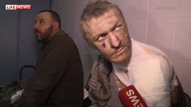 Кіборг Доберман мріє, щоб про воїнів памятали завжди