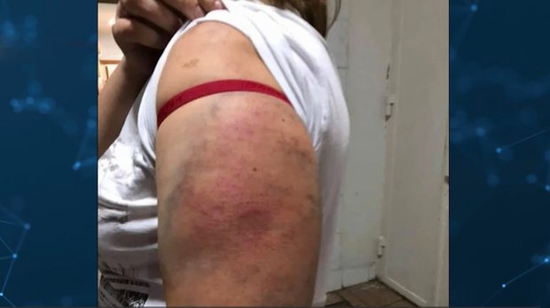 Моторошний реванш: поліцейські, які жорстоко катували людей, знову можуть повернутись на роботу