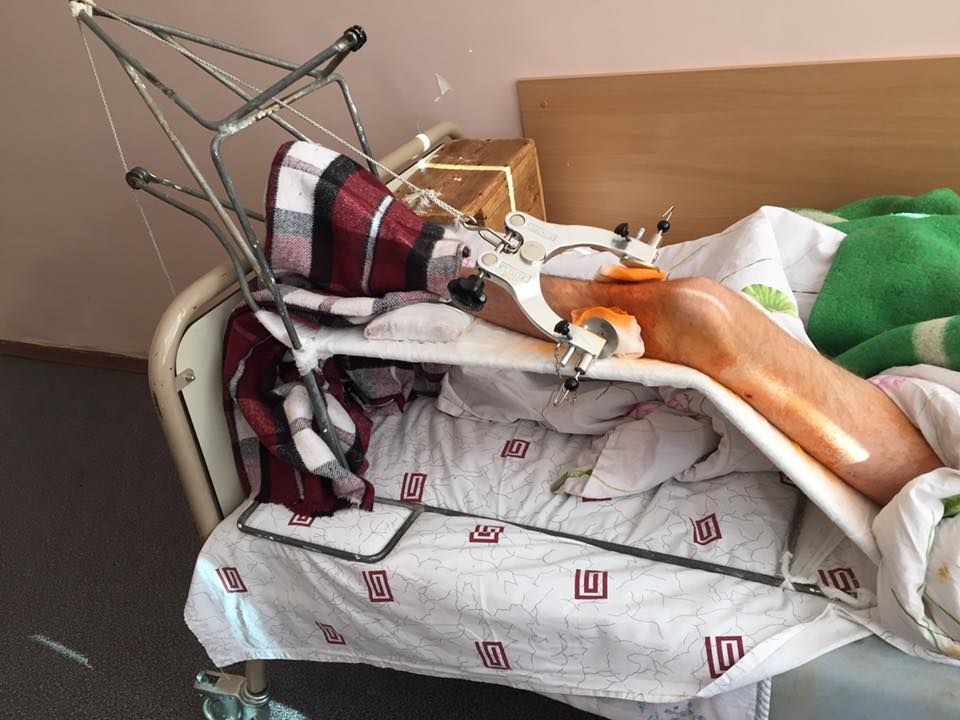 Химикуса, раненного из пистолета депутатом Пашинским, готовят к очередной операции