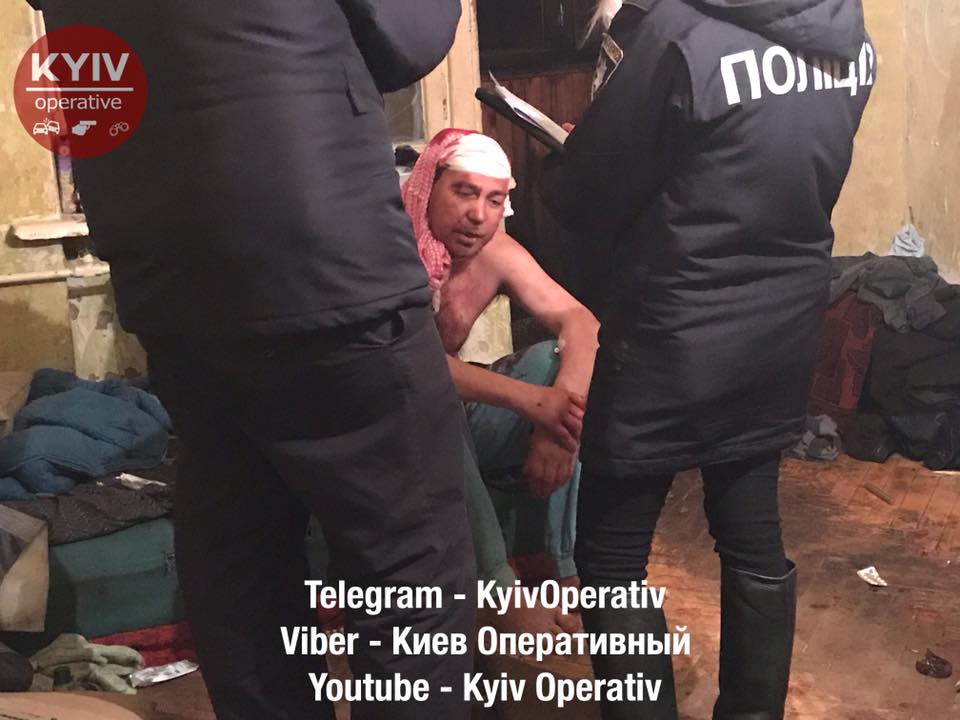 Кровавая вечеринка: В Киеве четверо мужчин подрались из-за девушки, двоих из них госпитализировали с ножевыми ранениями