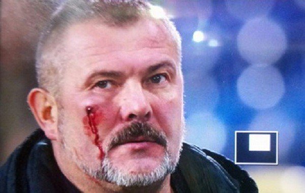 Нардеп Юрий Береза рассказал о драке на стадионе