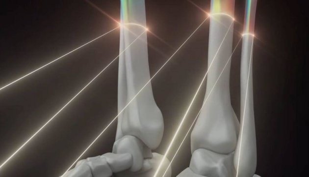 Украинский стартап будет печатать кости и органы человека на 3D-принтере (ВИДЕО)