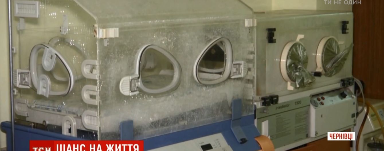 В Черновцах родилась девочка с двумя головами