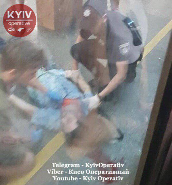 В Киеве на «Контрактовой площади» поезд метро ударил мужчину в голову (ФОТО 18+)