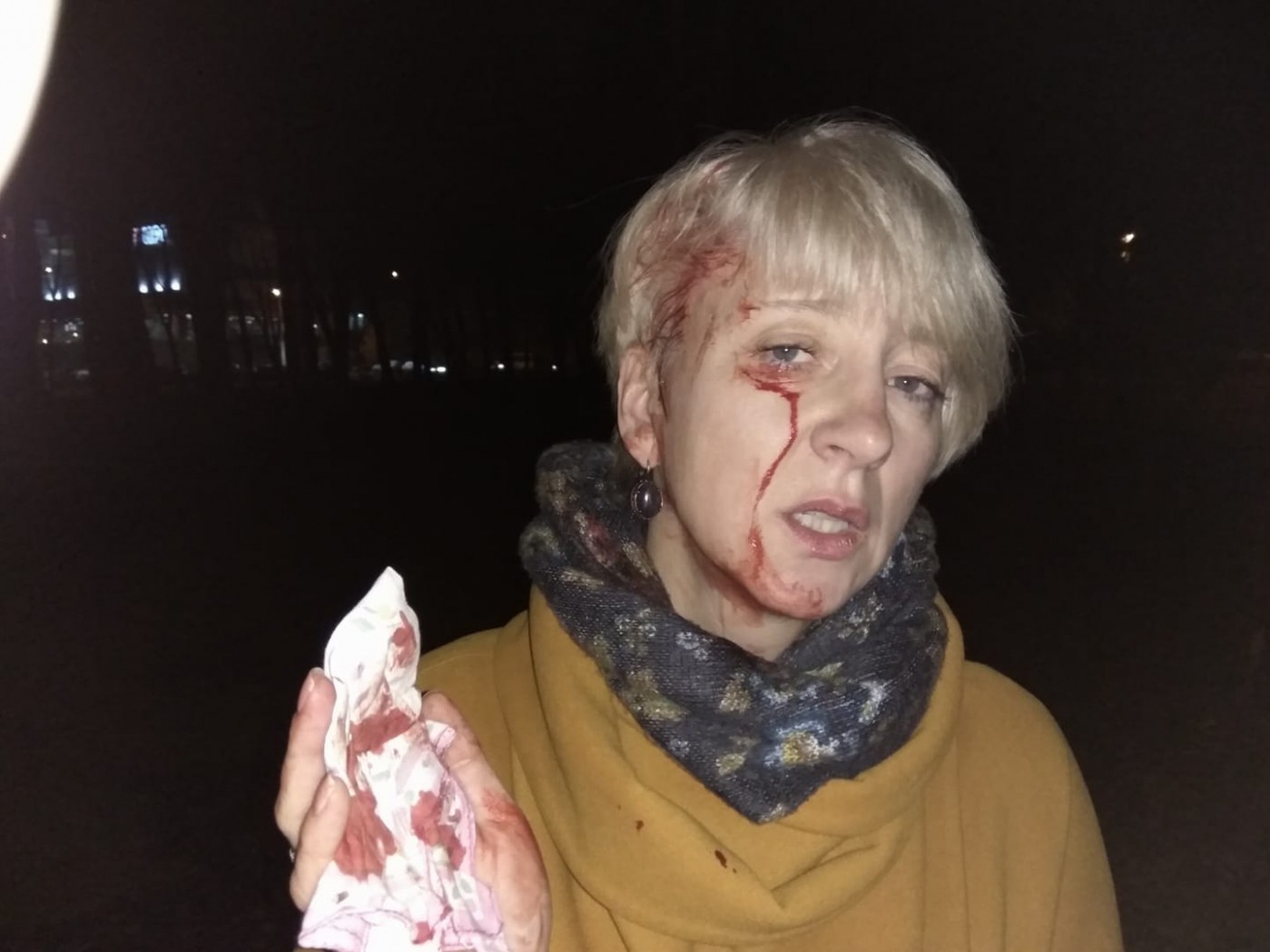 В Полтаве жестоко избили судью, которая в 2014 г. вела дело против мэра