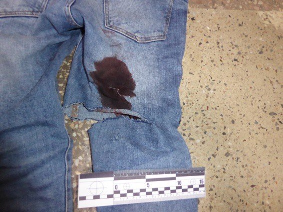 Выстрелили в ноги и ударили ножом в живот: В Киеве ранили мужчину, который в автобусе заступился за кондуктора