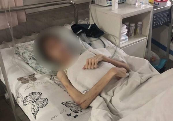 Гематомы и странное масло: отец, заморивший голодом 16-летнего одессита, рассказал о порче