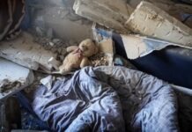 В Одессе из-за возгорания стиральной машинки пострадал мальчик